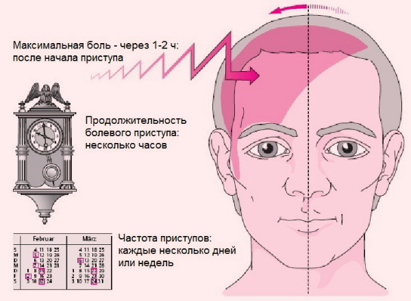 Что вызывает возникновение болей в области бровей, методы диагностики и лечения