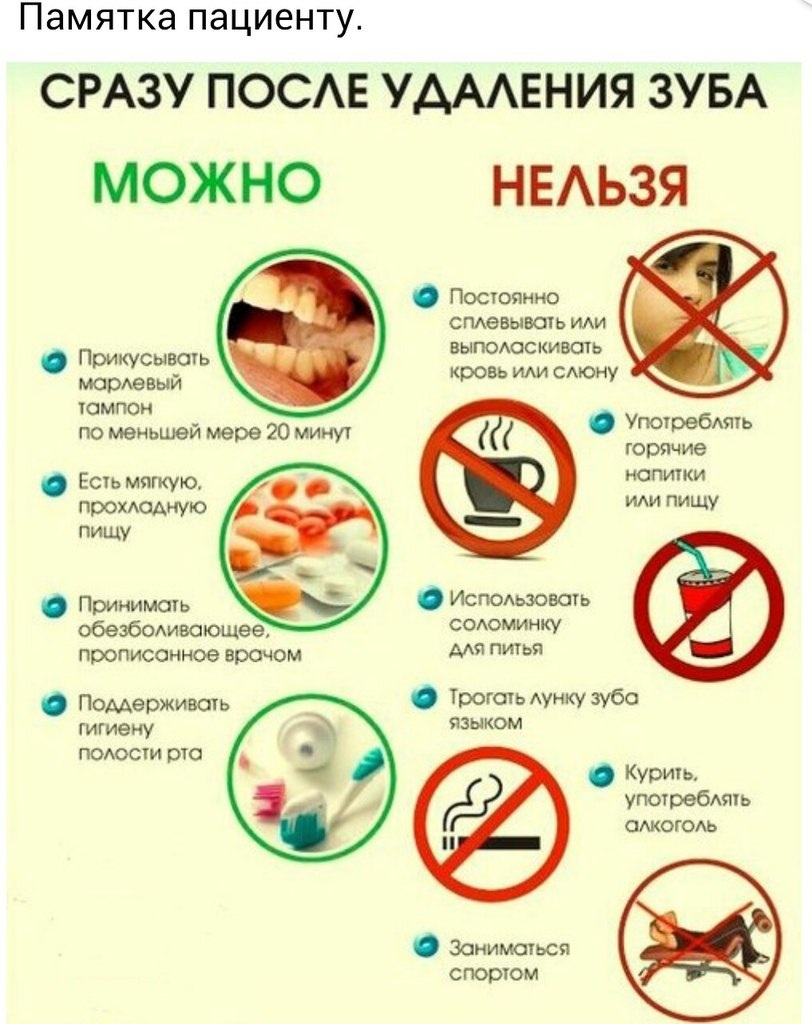 что можно и что нельзя делать после удаления зуба