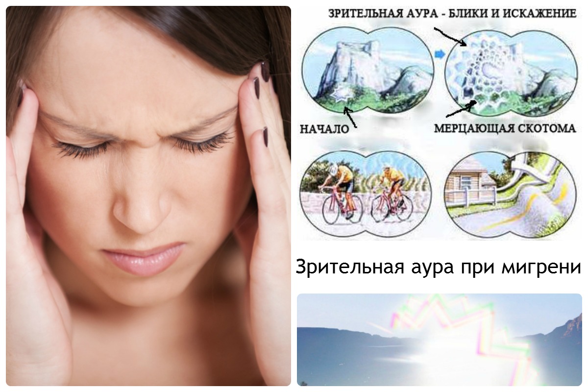 Болит голова у девушки, примеры ауры, чем опасна мигрень