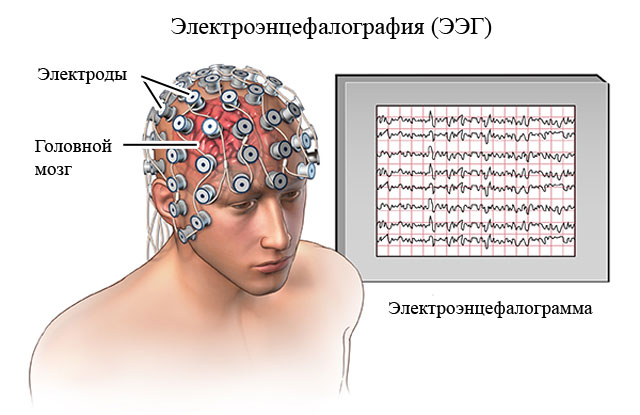 энцефалография