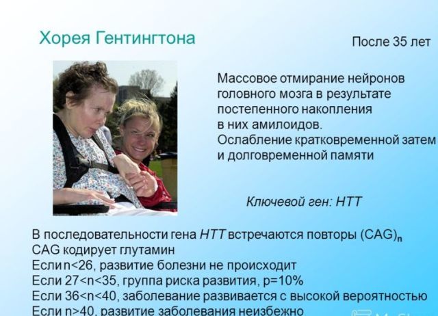 хорея Гентингтона