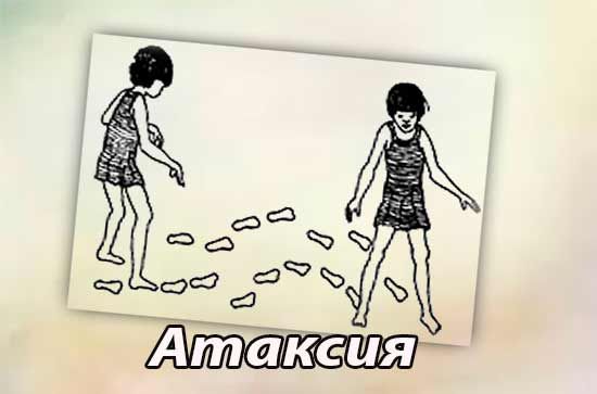 нарушение координаций движений