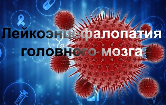 Причины возникновения