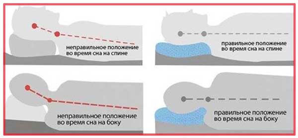 Положение во время сна