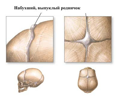 родничок