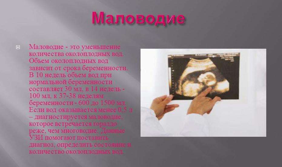 (маловодие
