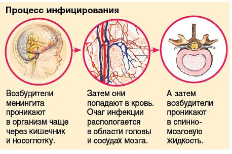 процесс инфицирования