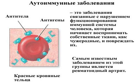 Аутоиммунные заболевания