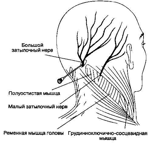 затылочный нерв