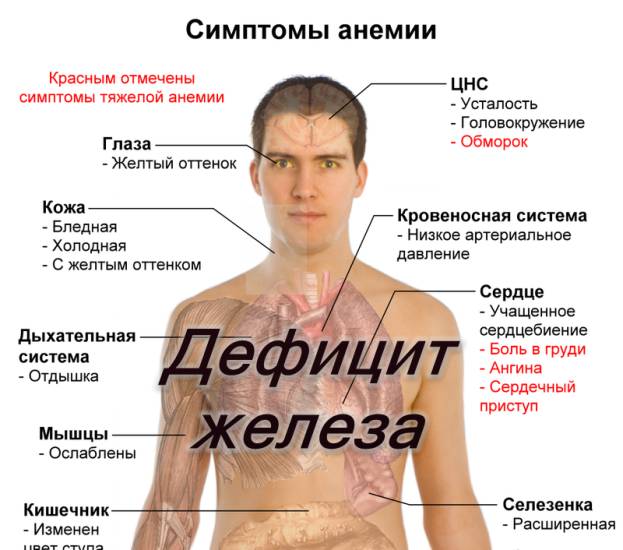 анемия