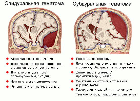 осложнения сотрясения мозга