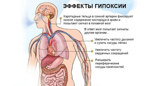 гипоксия