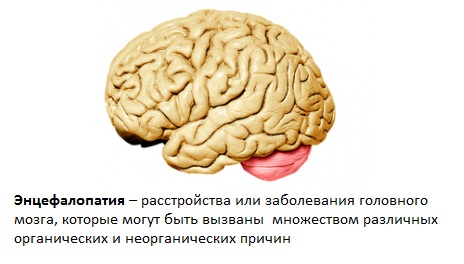 энцефалопатия