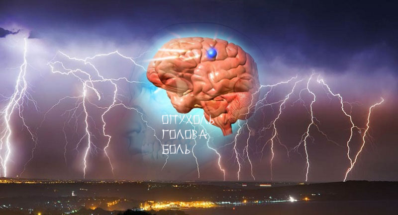 опухоль причина головной боли