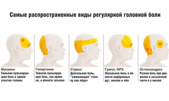 виды и характер головной боли