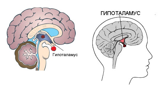 Гипоталамус и головная боль