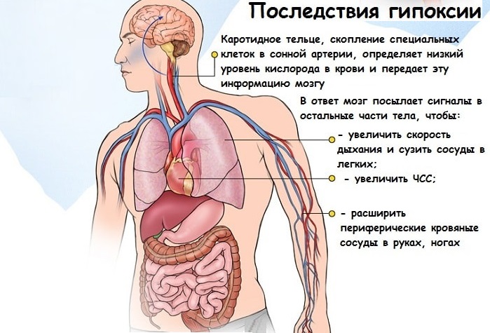 гипоксия