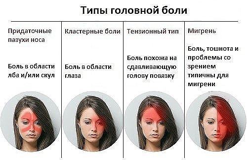 типы головной боли