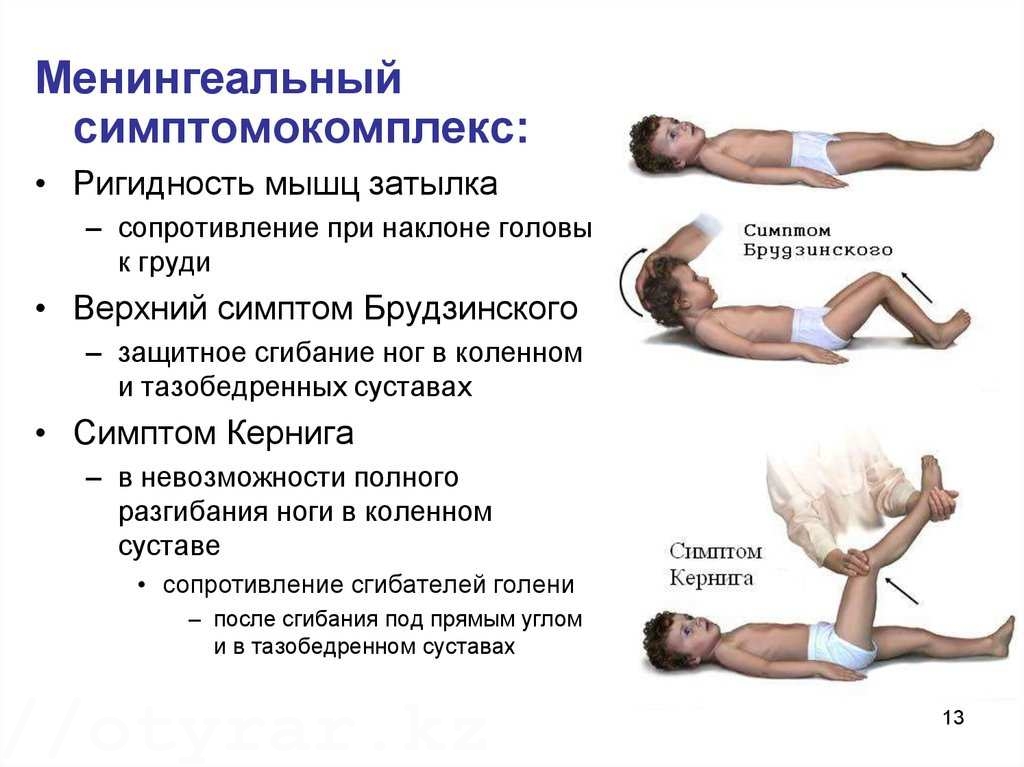 комплекс синдромов менингита
