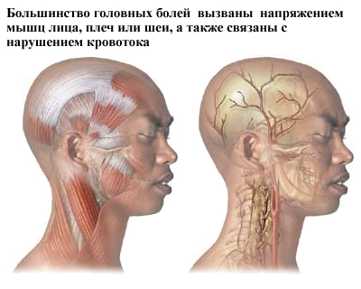 Причины возникновения головной боли напряжения