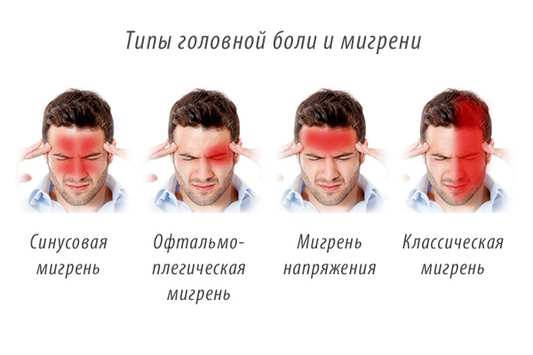 мигрень у детей - типы боли