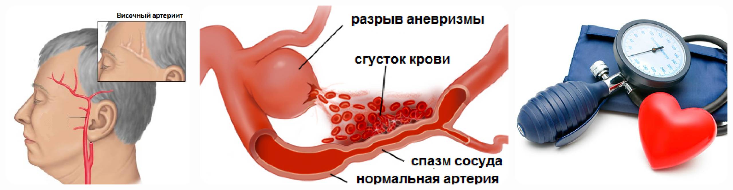 Причины боли в висках