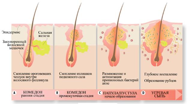 процесс воспаления волос