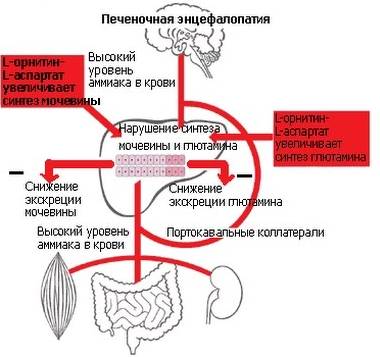 печеночная энцефалопатия