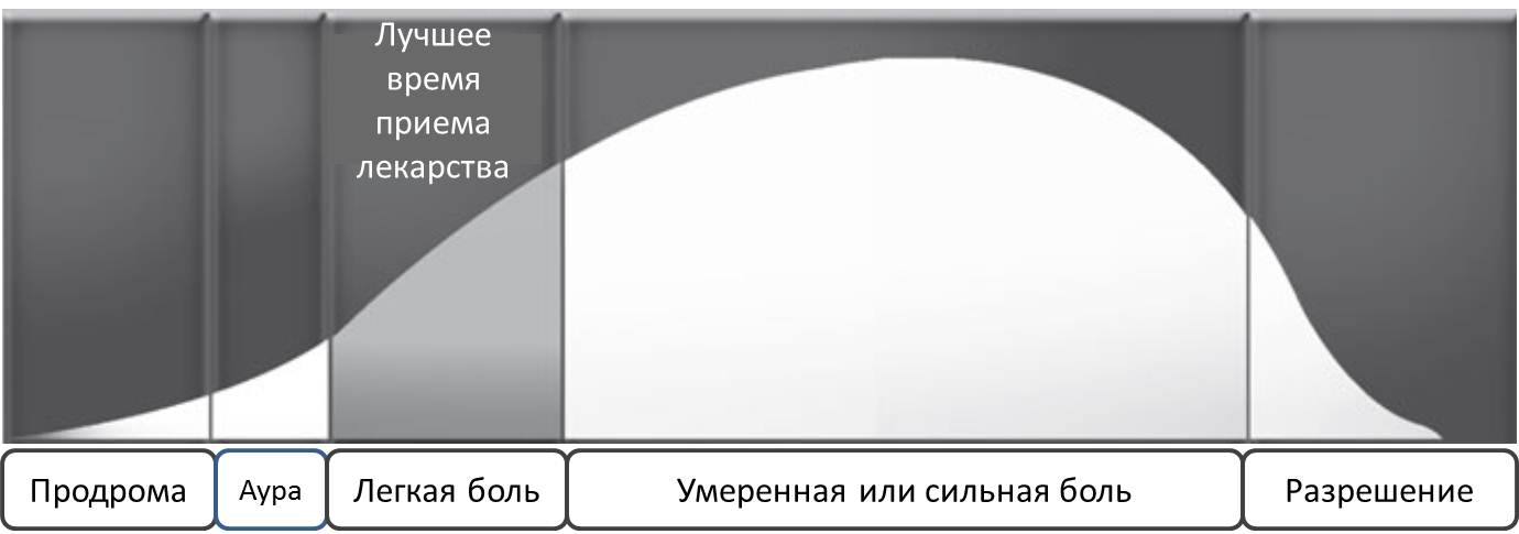 фазы мигрени
