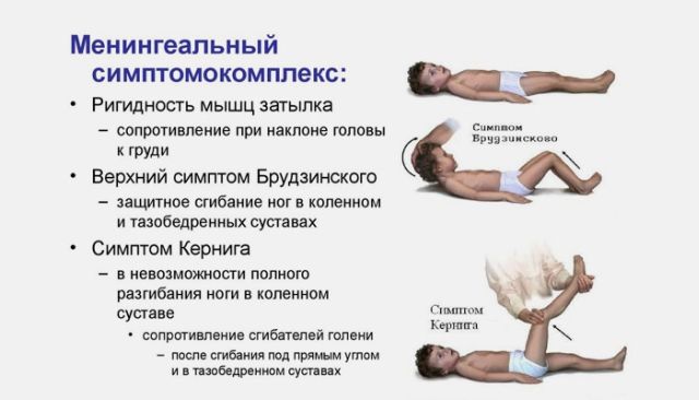 менингеальный синдромом