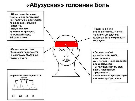Абузусная боль