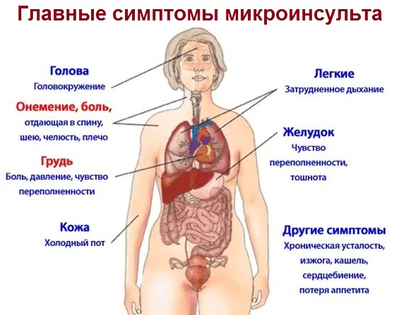 симптомы микроинсульта
