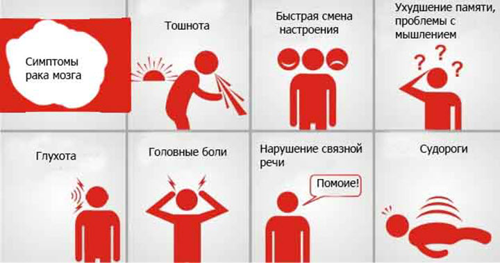 рак мозга - симптомы