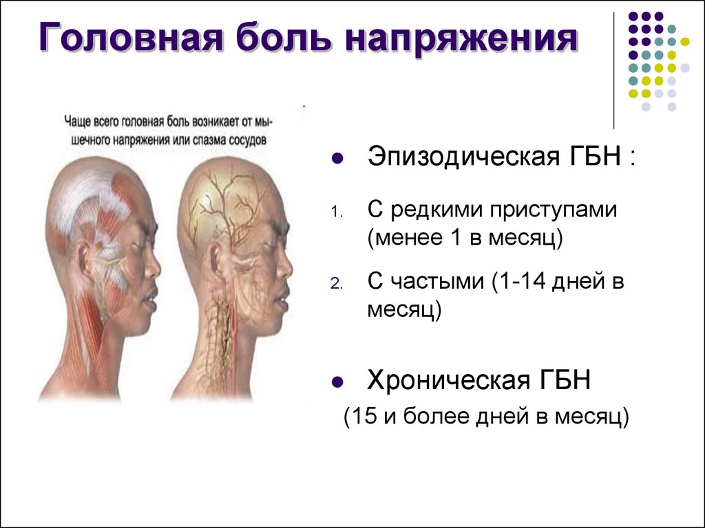 боль головная напряжения