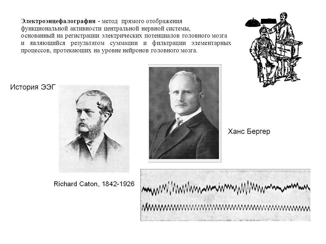 история ээг