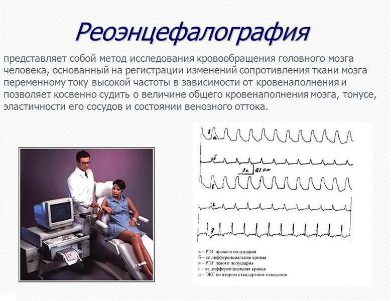 реоэнцефалограмма