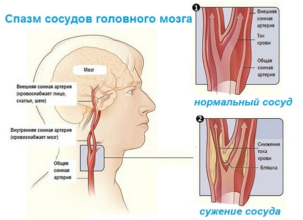 спазмов сосудов