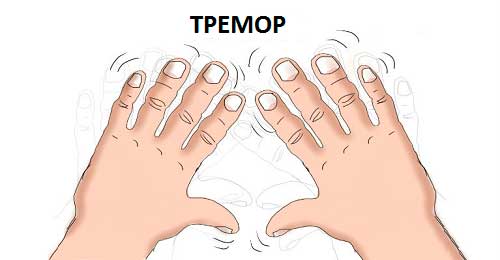 тремором конечностей