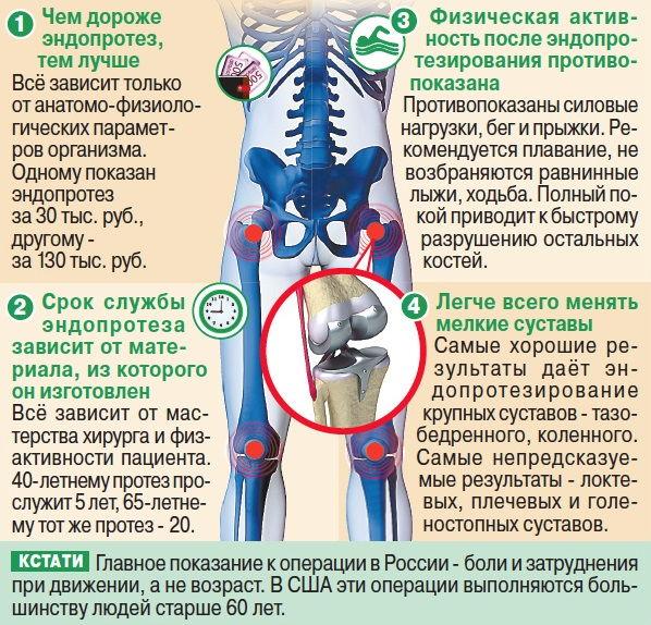 Эндопротезирование