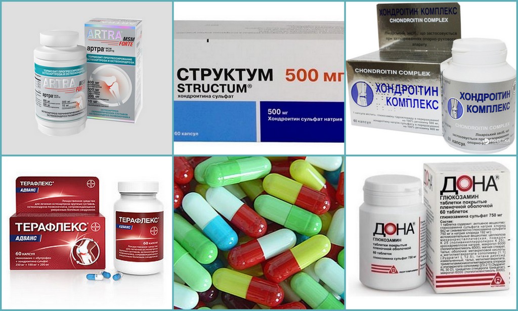 Хондропротекторы