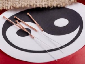 Что такое иглоукалывание — принципы применения иглотерапия