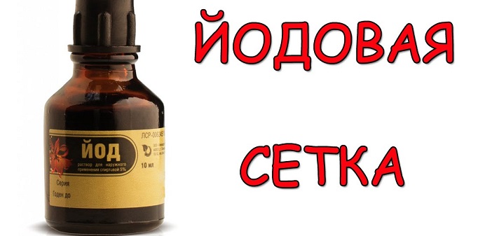 Йодовая сетка при подагре