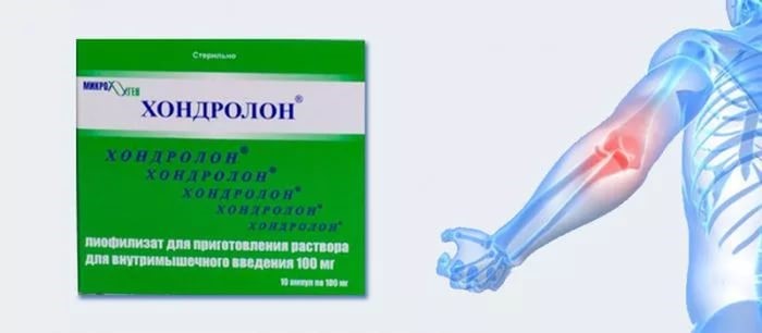 Хондролон