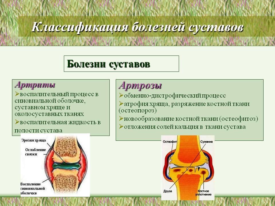 Классификация болезней суставов