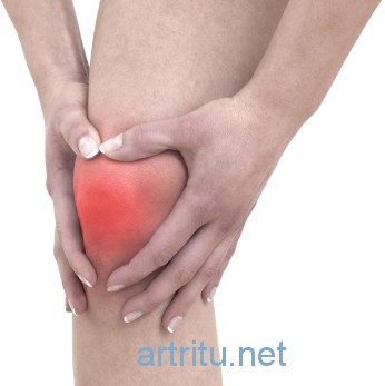 knee arthritis Коленный артрит