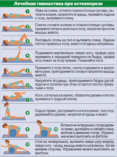 лечебная гимнастика при остеопорозе