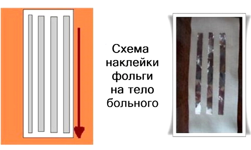схема наклейки фольги