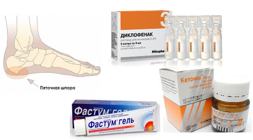 лекарства от пяточной шпоры