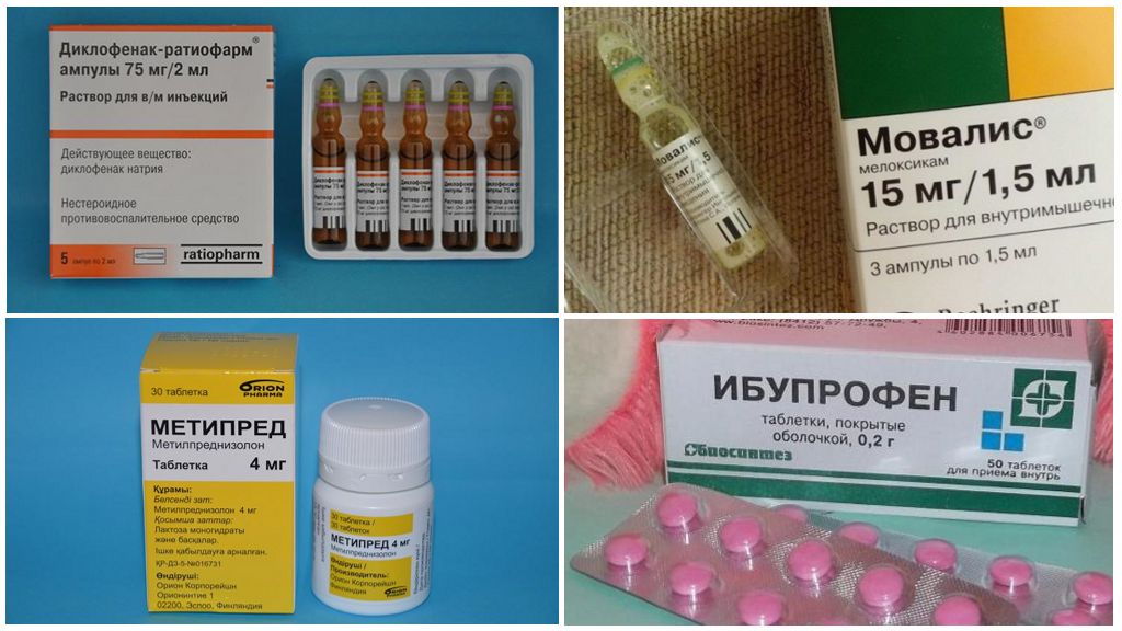 Лекарства при поражении суставов