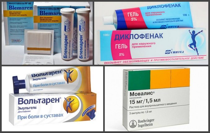 Лекарства для лечения подагры